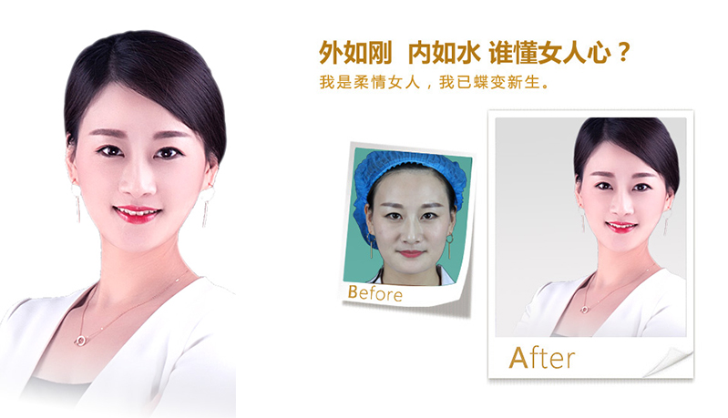鞍山V脸、线雕隆鼻